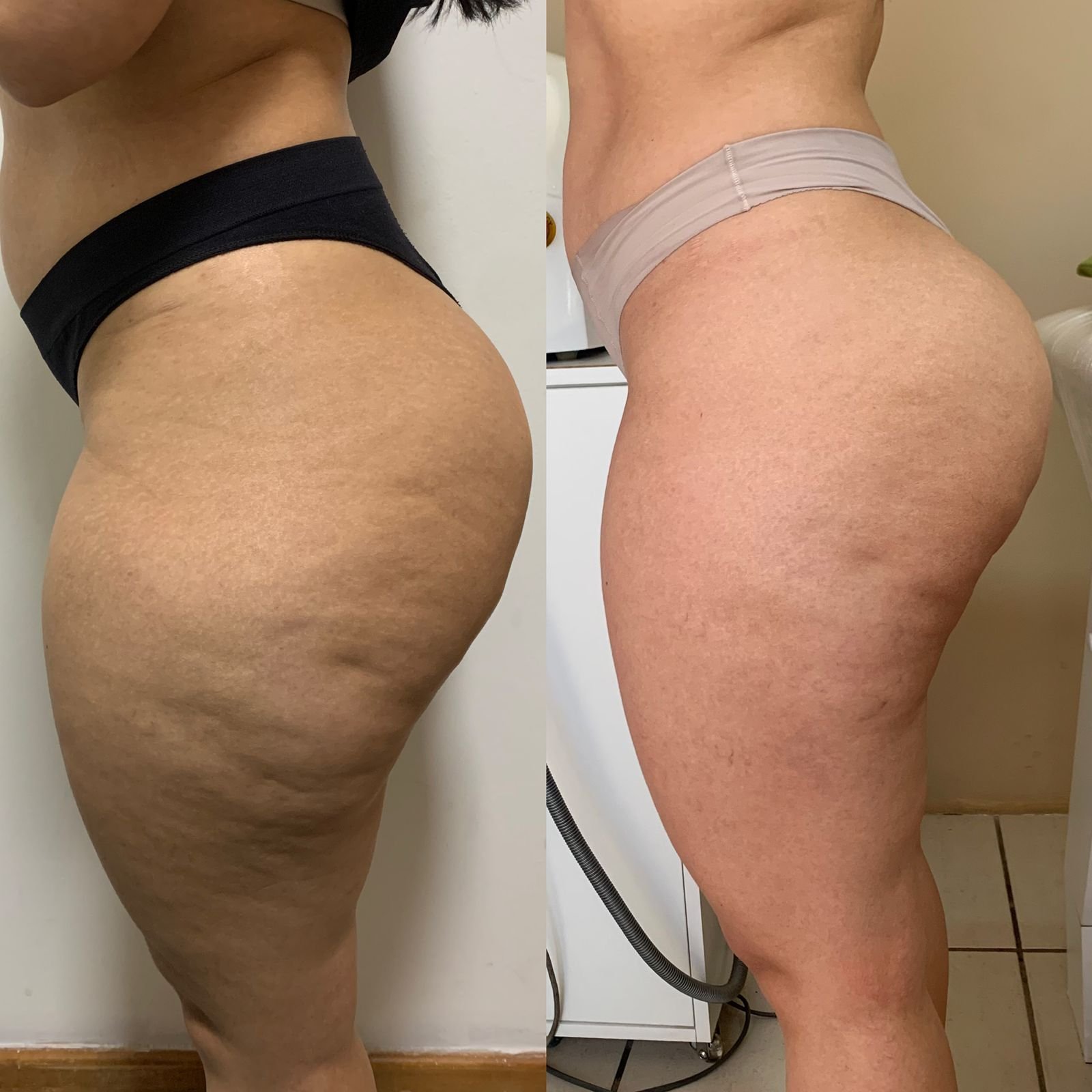 14 semanas • treino 4x/sem • 35–55 min